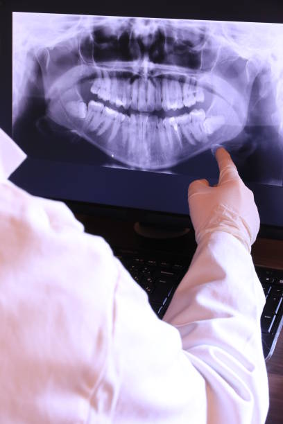 Best Emergency Treatment for Dental Infections or Abscesses in Flagtown, NJ